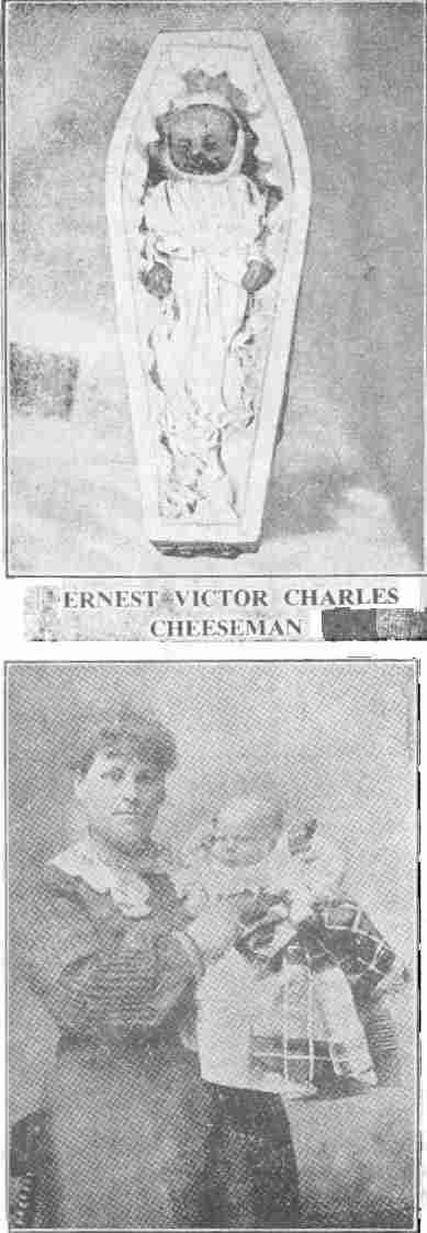 "Ernest Cheeseman, Rose Cottages, Wescott, Dorking, Anglia, kilenchetes korában, november 3-án a helyi kormányhivatal által biztosított szokásos glicerines borjúlimfával oltották be. Addig egészséges és normális volt, szülei pedig jó egészségnek örvendtek. Öt nappal az oltás után a szifiliszes bőrbetegség súlyos formája alakult ki, és november 30-án a halál szabadította meg szenvedéseitől. A testét ekcémaszerű kiütések borították, a lábai felhúzódtak, teljesen formátlanok voltak. A száj körül kitört sebek úgy néztek ki, mint az égett hús, és legalább fél centiméteresre álltak ki". (Az oltás a munkahelyen című cikkből) Amikor a szifilisz oltás következtében alakul ki, az orvosok szokásos állítása, hogy az anyának biztosan szifilisze van, és biztosan átadta azt a gyermeknek. Walesben, amikor 4000 csecsemőről derült ki, hogy szifiliszes az oltás után, az orvosok minden szülőt megvizsgáltak, hogy rájuk hárítsák a felelősséget, de a szülőkről kiderült, hogy szifiliszmentesek.