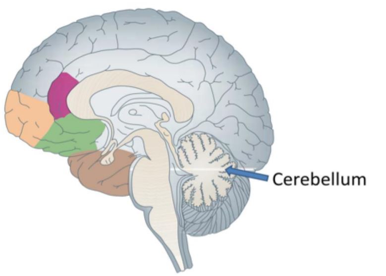 19. ábra – Autista alanyok kisagyának szürkeállománya rendkívüli bizonyítékkal szolgált, hogy ez lehet az agyi gyulladási folyamatok központja