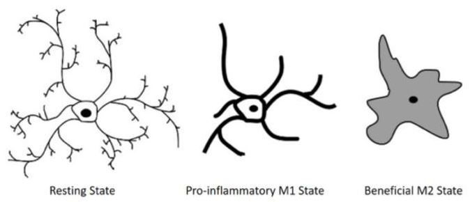 3. ábra – Mikrogliák 3 külöböző állapota